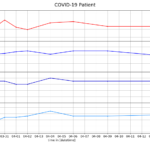 Cosinuss COVID-1ß Experience Report Plot of Vital Sign Monitoring