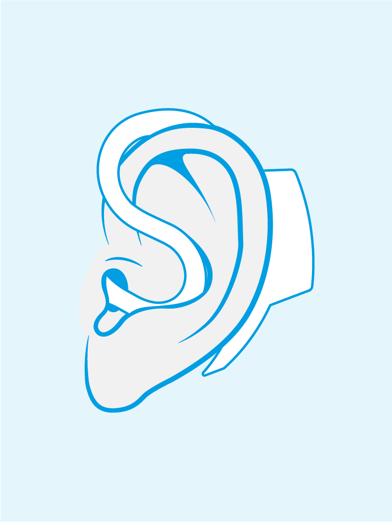 CMED_Web_ProductsOverview_XXXX_V01_Acquisition Illustration of the cosinuss° sensor worn on an ear.