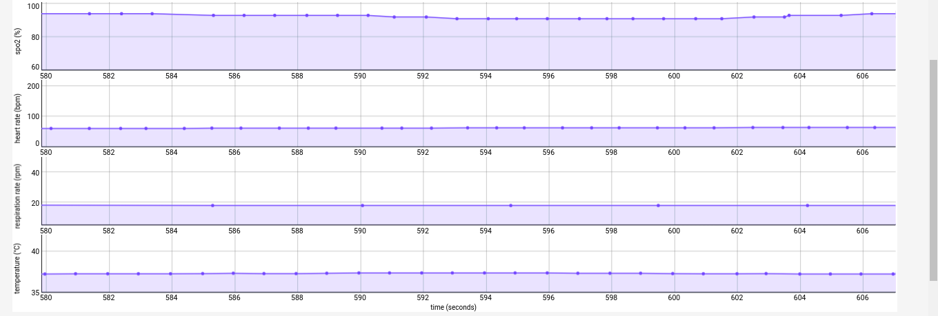 Cosinuss-DataAnalytics-good_vital_signs