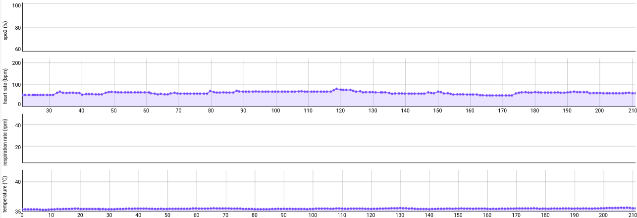 Cosinuss-DataAnalytics-no_vital_signs